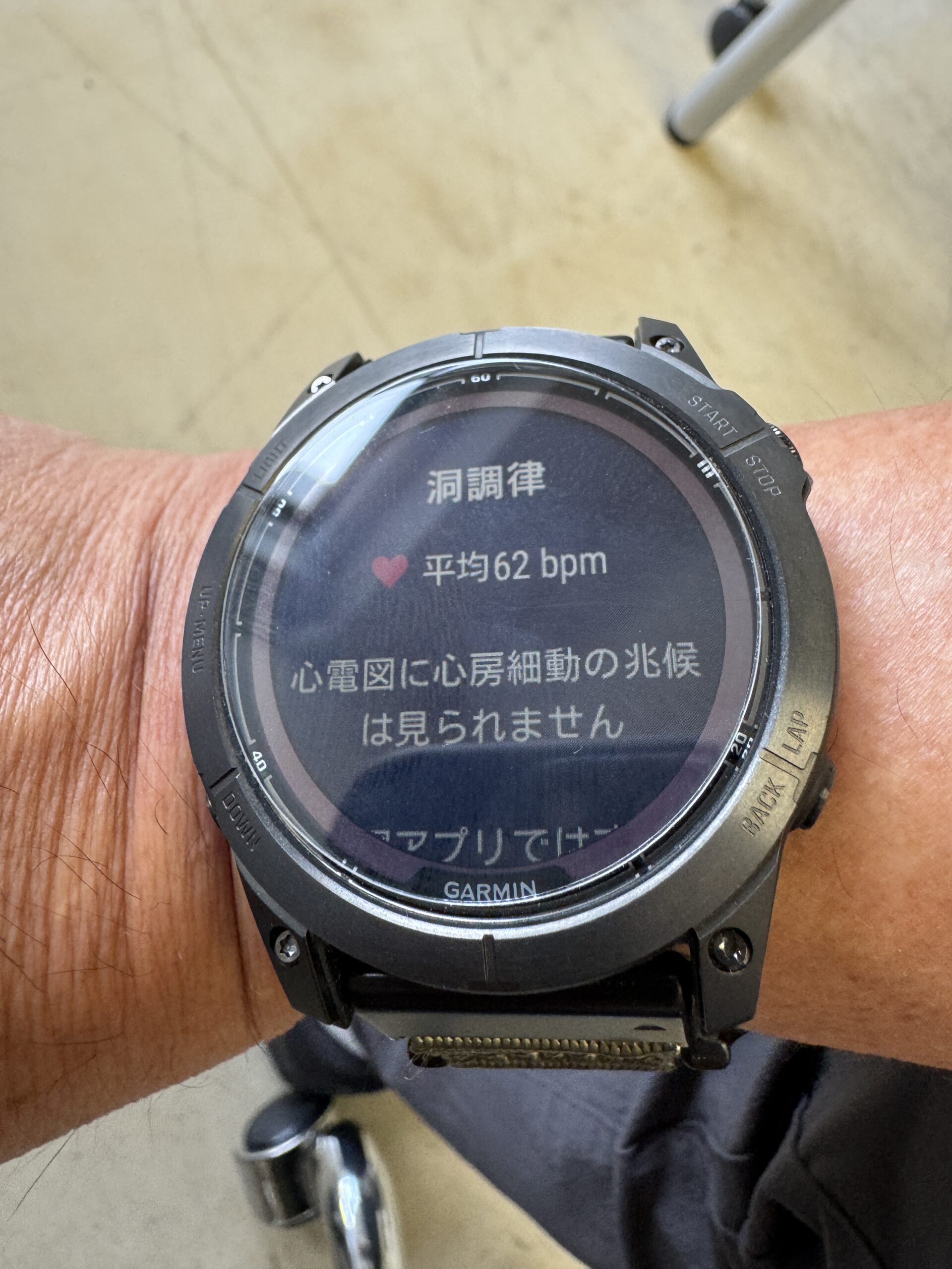 fenix 7X Proで測定した心電図の結果画面。洞調律・平均62bpmと表示されている